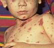 Источник: kidshealth.org - увеличить!