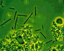 Lactobacillus